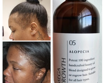Potent 100 Ingredients Ayurvedic Mega Growth Hair Oil Thickens Strengthens Fast Absorbing Lightweight Non Greasy All Hair Types