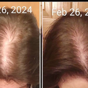 Caucasian female before and after 30 day hair growth results