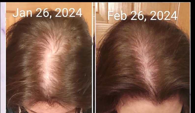 Caucasian female before and after 30 day hair growth results