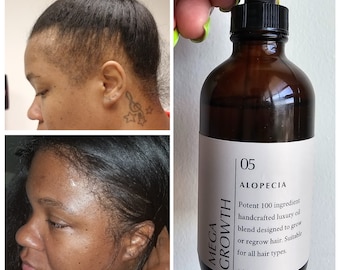 100 Ingredient POTENT EXTREME Hair Growth Oil Thickens Strengthens Fast Acting Fast Absorbing Lightweight Non Greasy All Hair Types