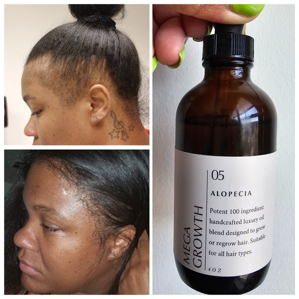 100 Ingredient POTENT EXTREME Hair Growth Oil Thickens Strengthens Fast Acting Fast Absorbing Lightweight Non Greasy All Hair Types