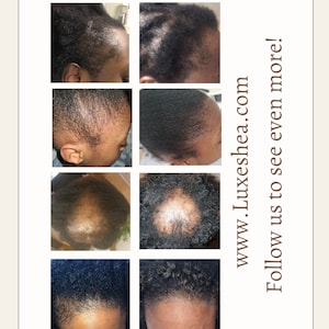 Ayurvedic hair/beard growth oil, herbal hair growth oil, Fast hair growth serum, hot oil treatment.