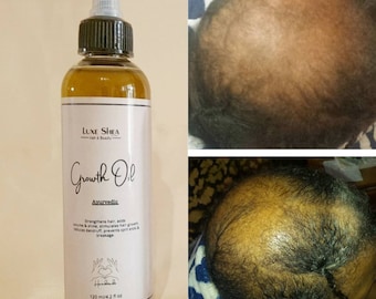 Ayurvedic Growth Oil | Herbal Serum for Stronger Hair & Beard | Natural Scalp Nourishment