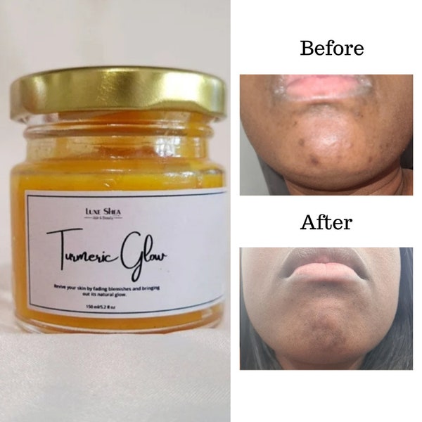 Turmeric hydrating mask, pure aloe vera gel, Face treatment mask, Soothing Aloe Vera mask, blemishes, brighter skin