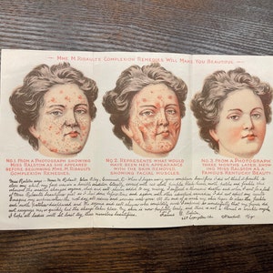 May include: An antique advertisement for Mme. M. Ribault's Complexion Remedies. The image features three portraits of Miss Ralston, illustrating the effects of the treatment. The first shows her before, the second with skin removed, and the third after three months of treatment.