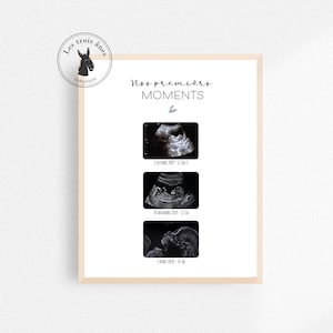 Posters - ultrasound - pregnancy - motherhood - memories