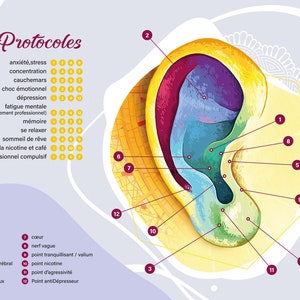 Medizinisches Poster zur Aurikulotherapie und ihren Vorzügen