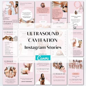 Editable Ultrasound Fat Cavitation Instagram Story Templates, Body Sculpting IG, Body Contouring Digital Graphic, Social Media Content