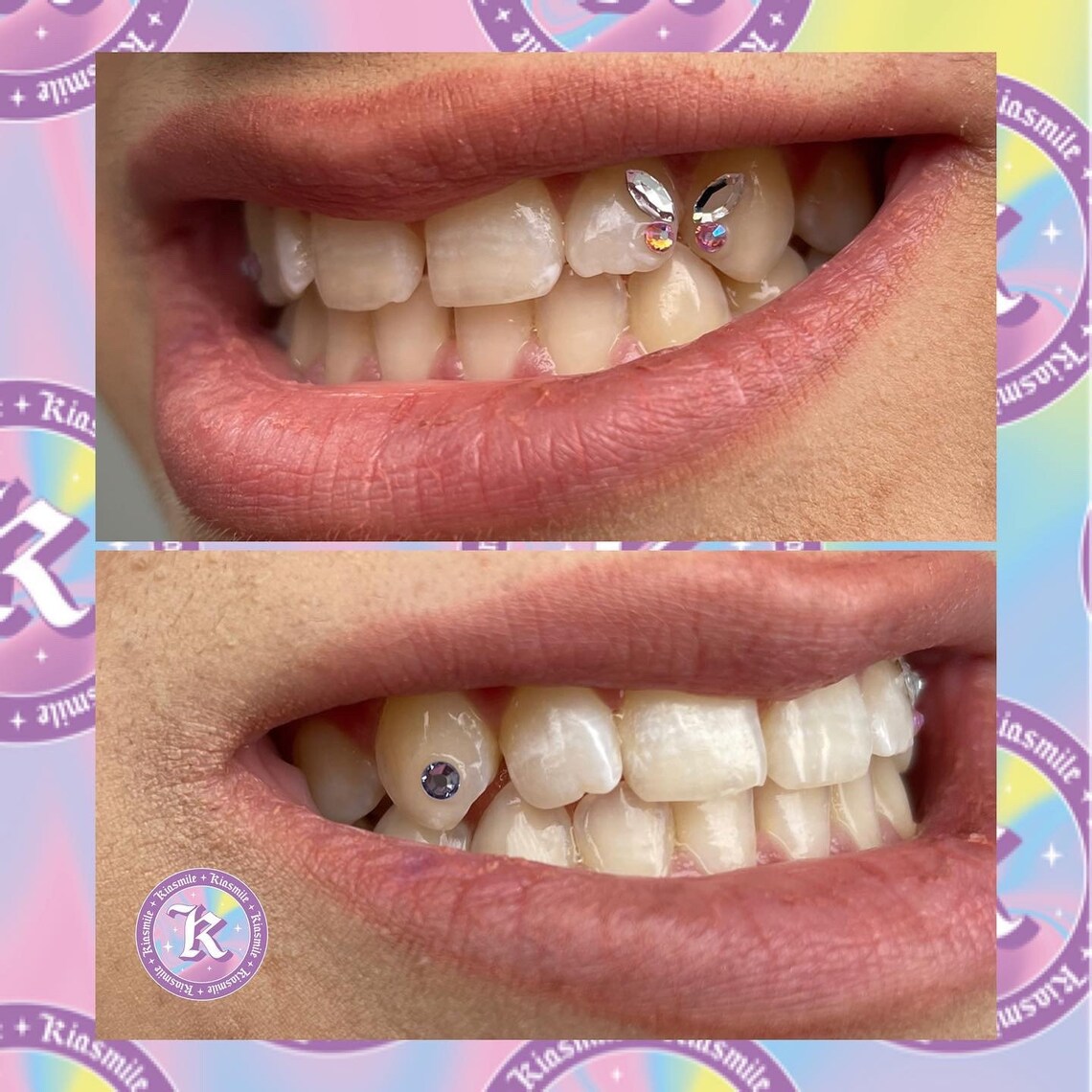 BUTTERFLY Tooth gem home kit Etsy