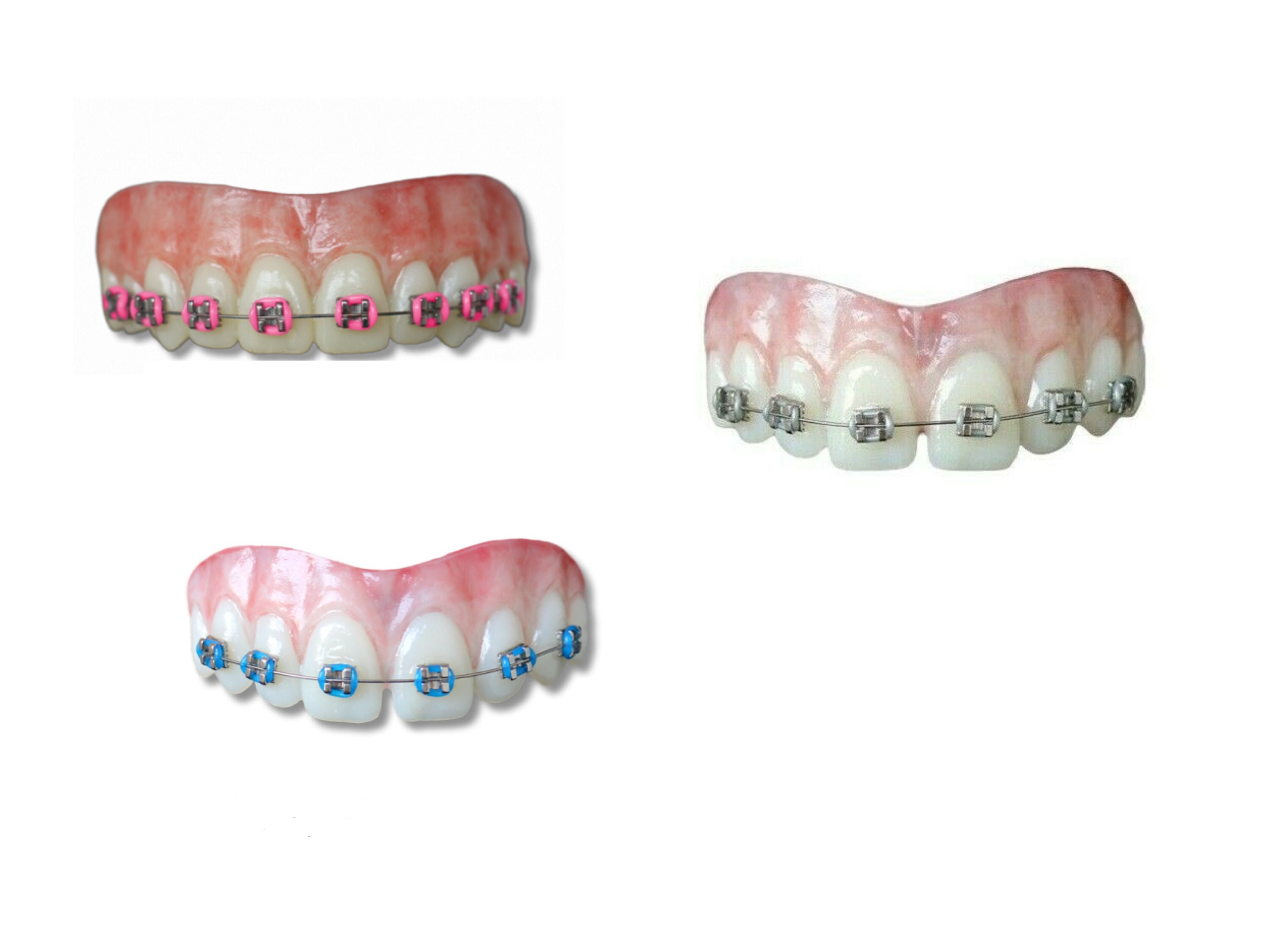 Ugly betty fake braces