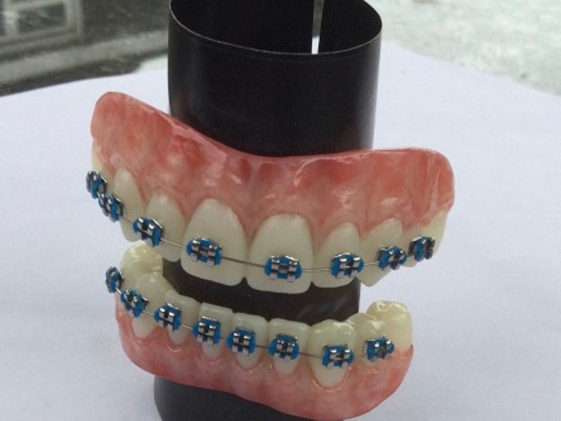 Braces Prosthetic Teeth Cosplay Ugly Betty Teeth Adult Etsy