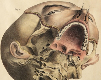 1867 Antique engraving of HUMAN ANATOMY: HEAD. Otorhinolaryngology. Orl. Mouth. Surgery. Doctor Gift. Medicine. 157 years old print.