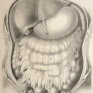 Antica litografia del 1879 di ANATOMIA UMANA. Apparato digerente. Stomaco. Intestino. Chirurgia. Medicina. Dono del dottore. Stampa di 145 anni fa.