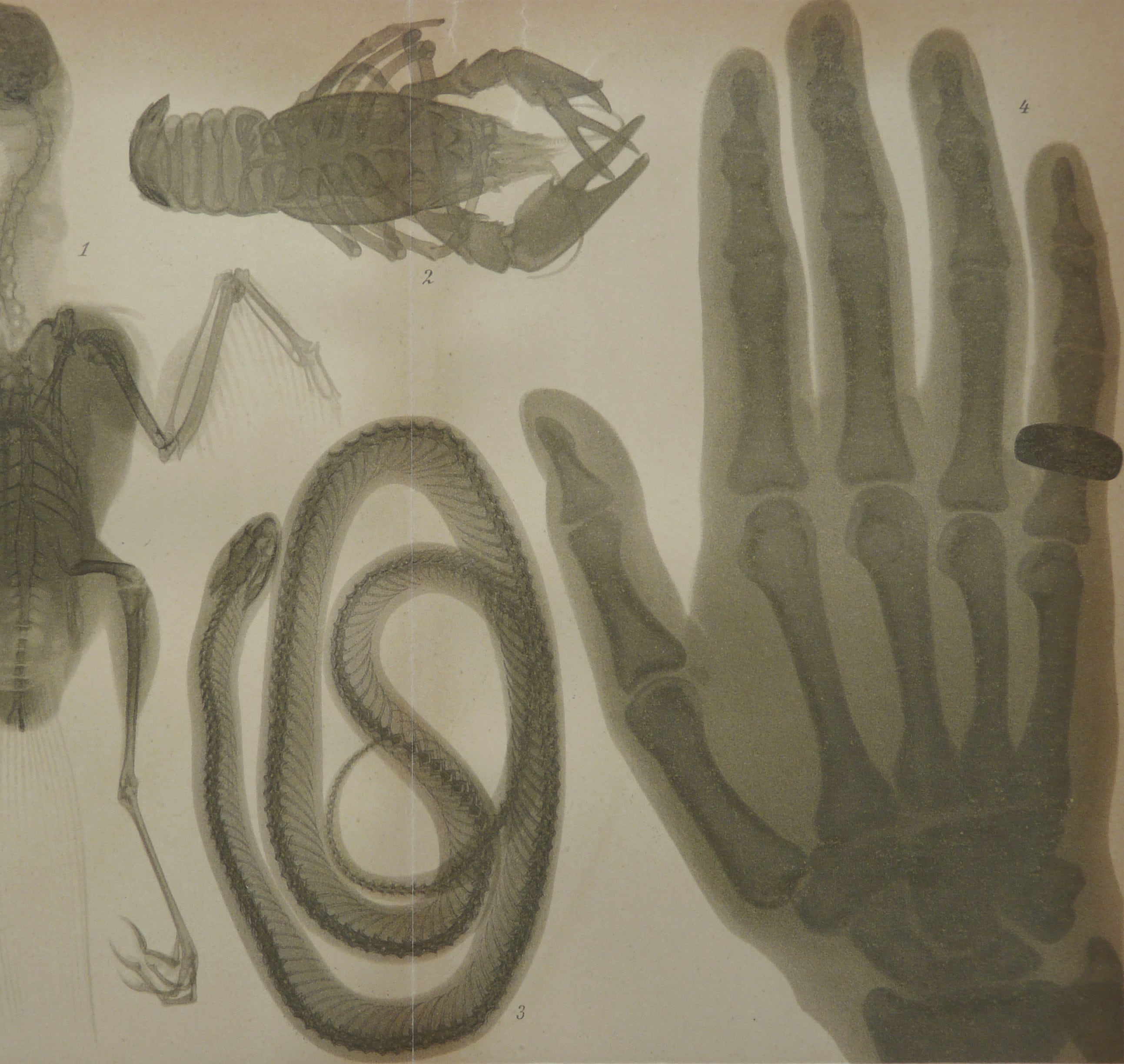 1897 Antique Lithograph of X-RAY. RADIOLOGY. Ancient Radiography ...