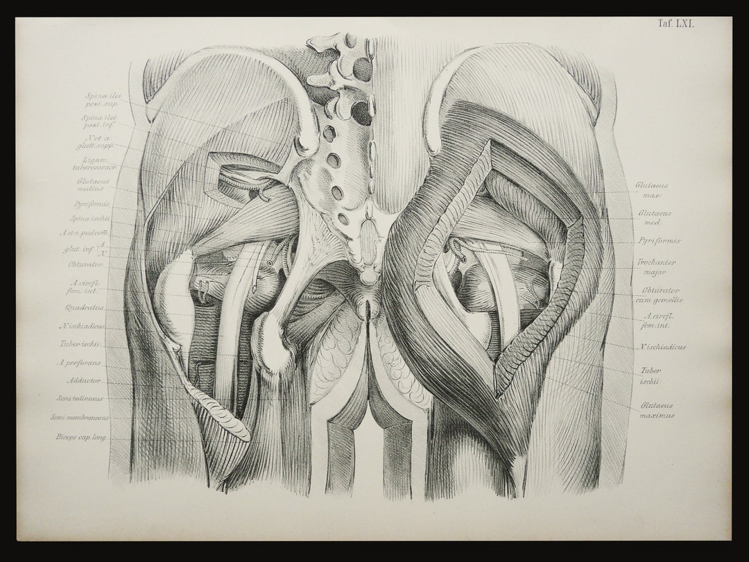1879 Antique Lithograph of HUMAN ANATOMY. PHYSIOTHERAPY. Back, Glutes ...