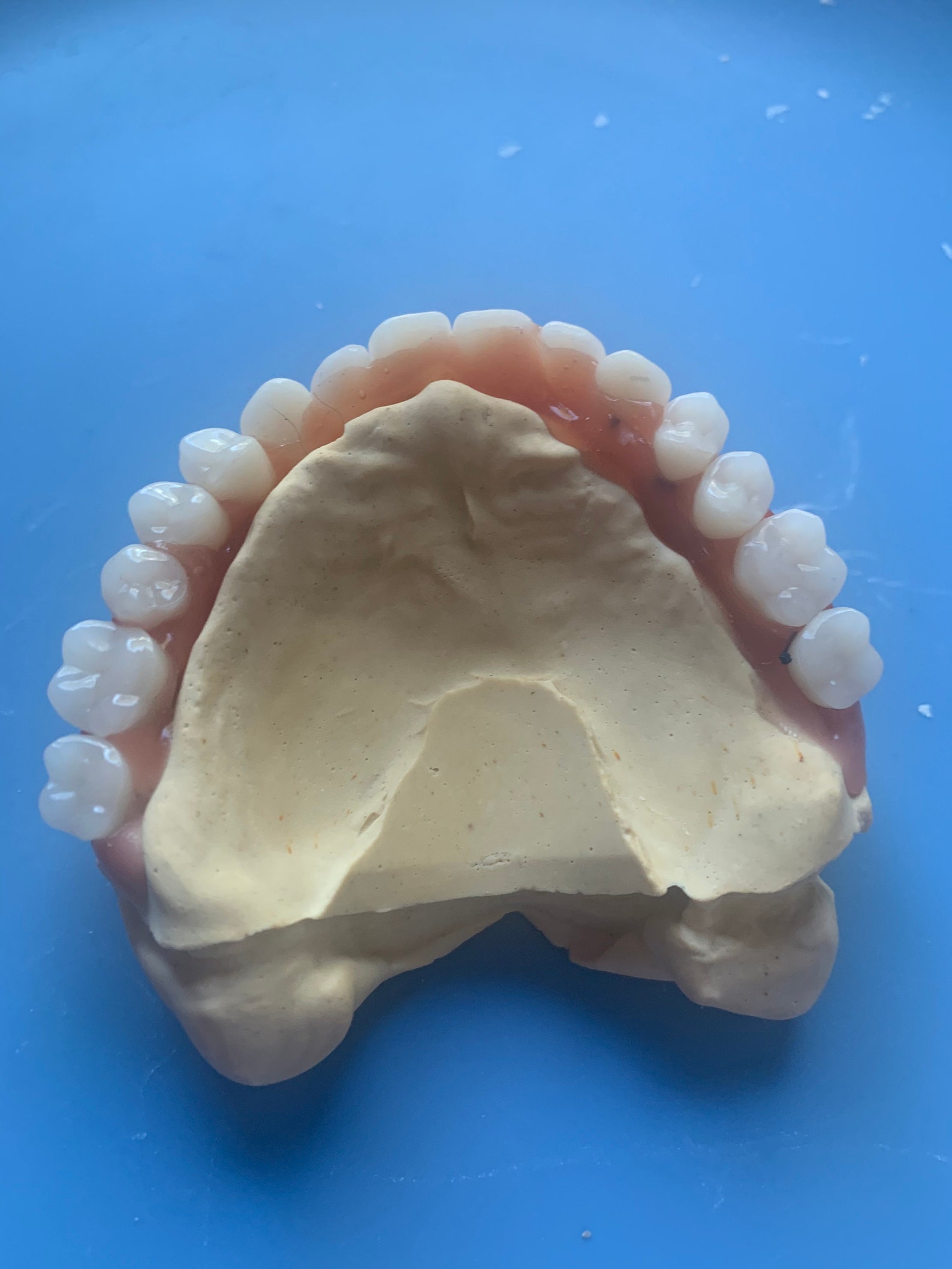 6pc DIY Denture Impression Cast/ Mold kit with Lab Tools Etsy