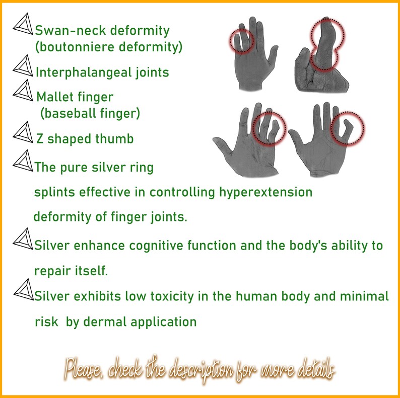 Arthritis Finger Splint Ring EDS Splint 925 Pure Silver Etsy