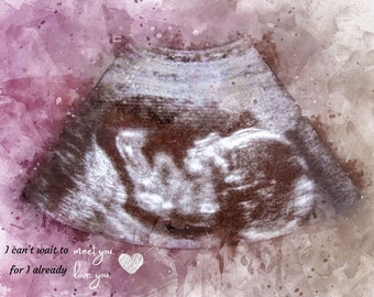 Baby Ultrasound Art, Gift for Grandmother, Watercolor Sonogram Print, Ultrasound Art for Wall Baby Shower Gift Sonography Art Pregnancy Gift