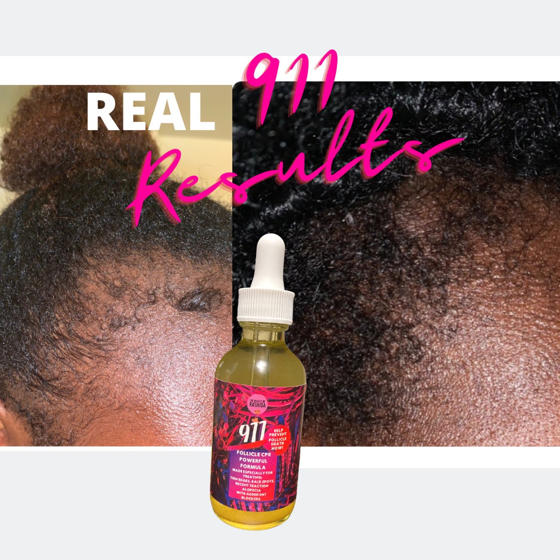 How to Grow Edges Edge Growth Oil Hair Growth Oil How to Etsy
