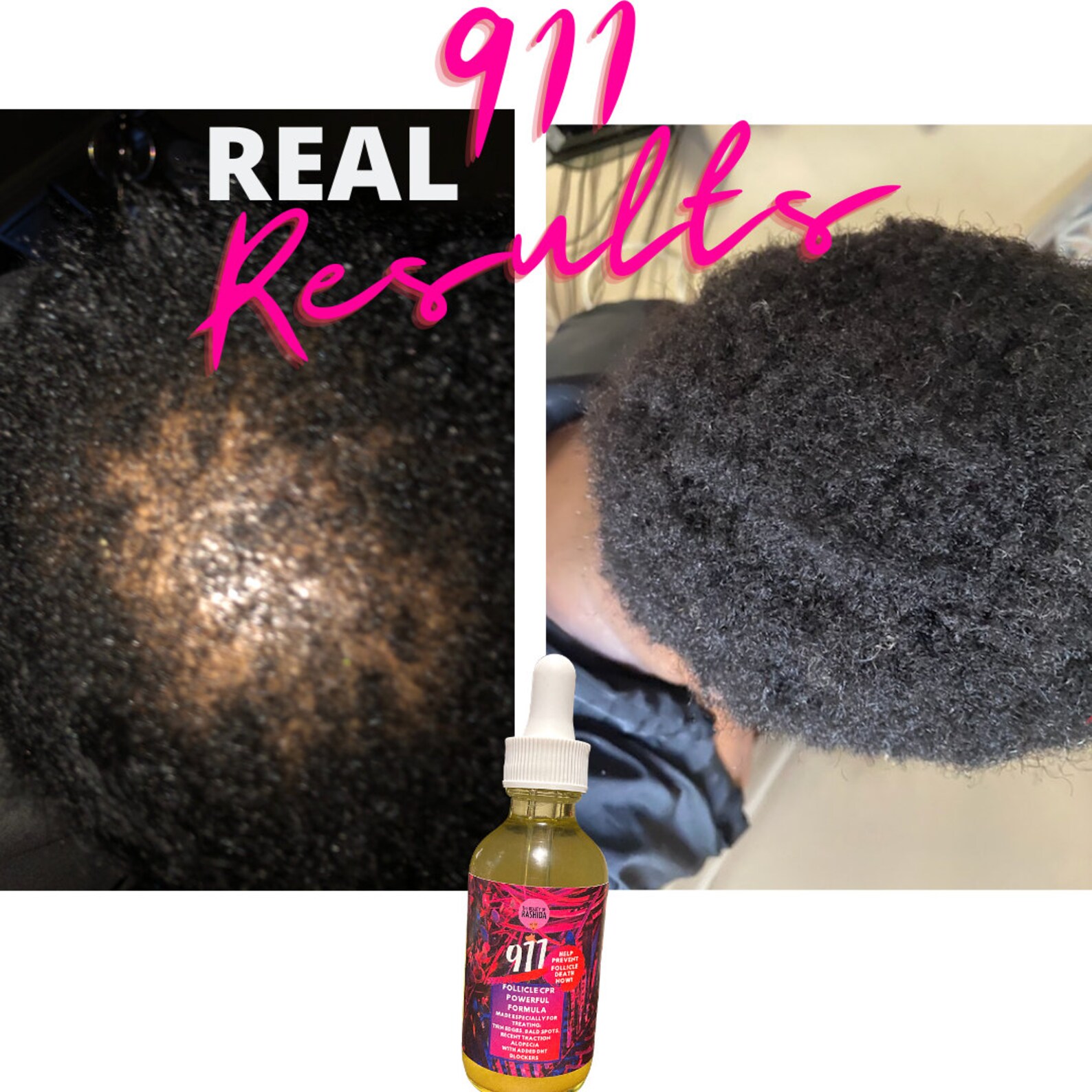 How to Grow Edges Edge Growth Oil Hair Growth Oil How to Etsy