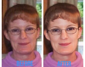 photo quality enhancement