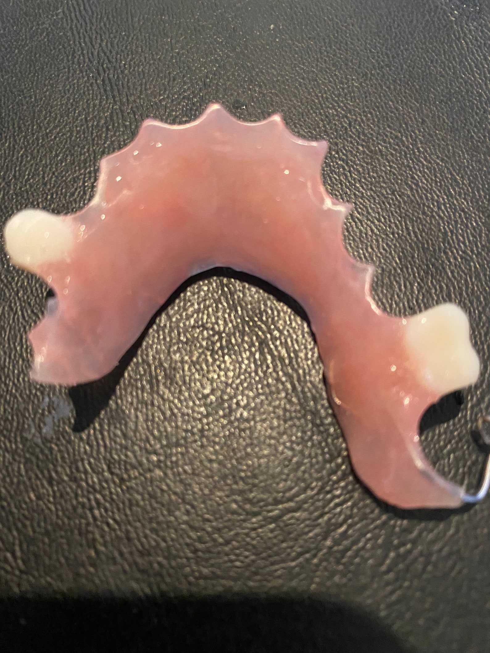 2 tooth flipper with impressions kit Etsy