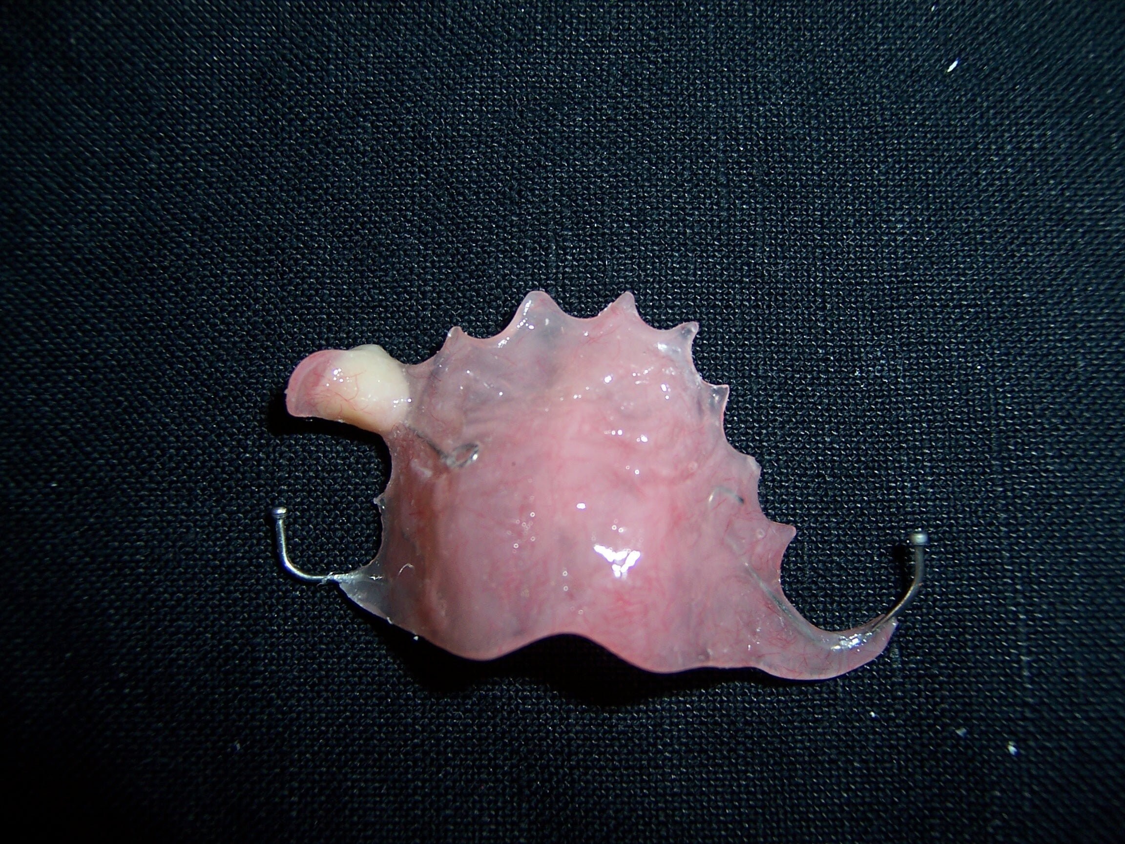 Flipper replacing a missing tooth Impression kit included Etsy