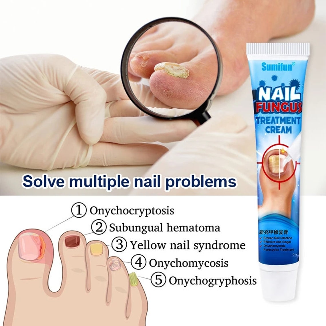 Chinese Herbal Toe Nail Fungus Treatment Cream Onychomycosis Etsy