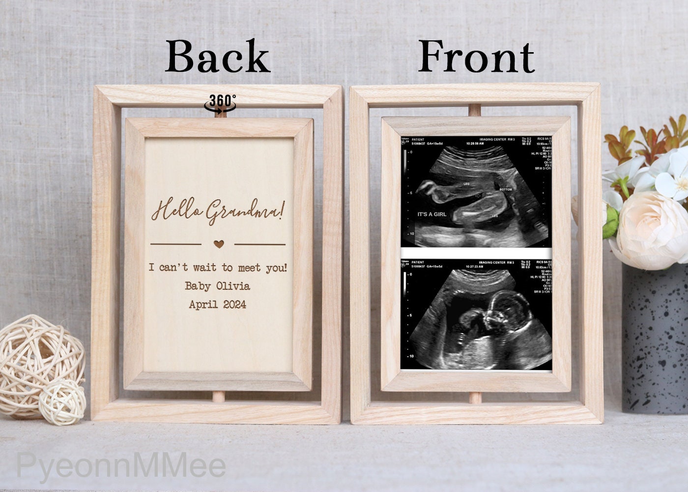Heart's Sign Sonogram Cadre photo, Cadeau pour future maman et maman  enceinte, Cadres photo à ultrasons