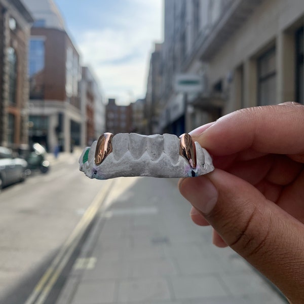 14k Rose Gold Teeth Caps