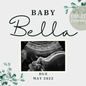 Digital Pregnancy Announcement. Social Media Gender Neutral Baby Reveal. Pregnant Announcement Template. Instagram Facebook Ultrasound Baby