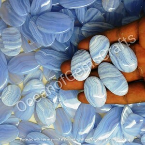 May include: A close-up of a hand holding several oval-shaped blue agate stones. The stones have a light blue and white banded pattern. The stones are surrounded by more of the same stones.