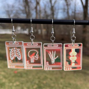 May include: Four pairs of earrings with a red and white holographic effect. Each earring features a different medical x-ray image: a chest x-ray, a skull x-ray, a hand x-ray, and a spine x-ray.