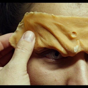 May include: A close-up of a person's face with a flesh-colored prosthetic covering one eye. The prosthetic is textured and has a small hole in it. The person is wearing white contact lenses.