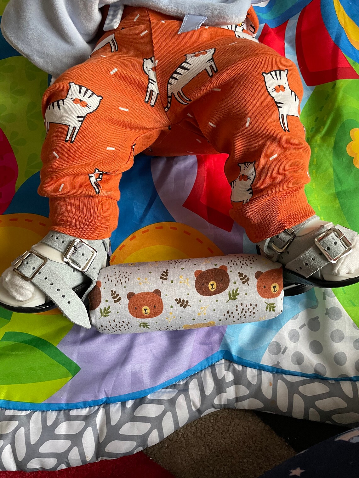 Clubfoot Boots & Bar Cover Surtido Clubfeet Talipes Etsy