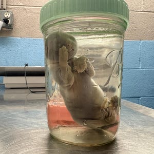 May include: A clear glass wide-mouth mason jar with a light green plastic lid, containing a preserved fetal specimen submerged in a translucent liquid. The jar features embossed measurement markings on the side and a script logo on the front surface.