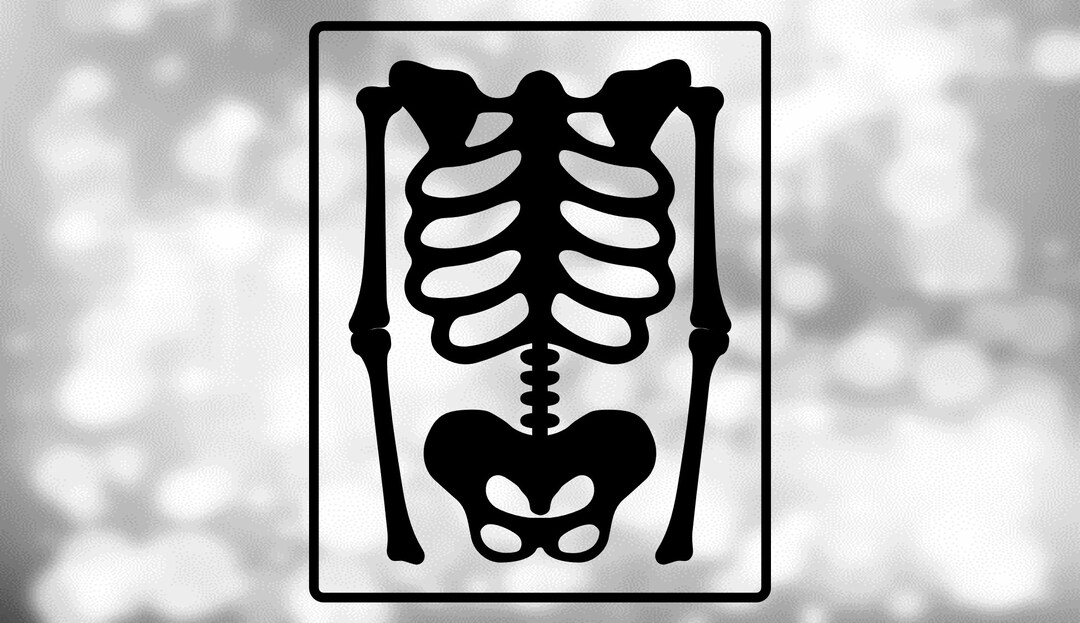 X Ray Clipart Black And White