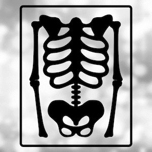 Medische Clipart: Zwarte tekening van skelet röntgenfoto van torso / bovenlichaam van radiologie voor artsen, radiologen - Digitale download SVG &gt; PNG
