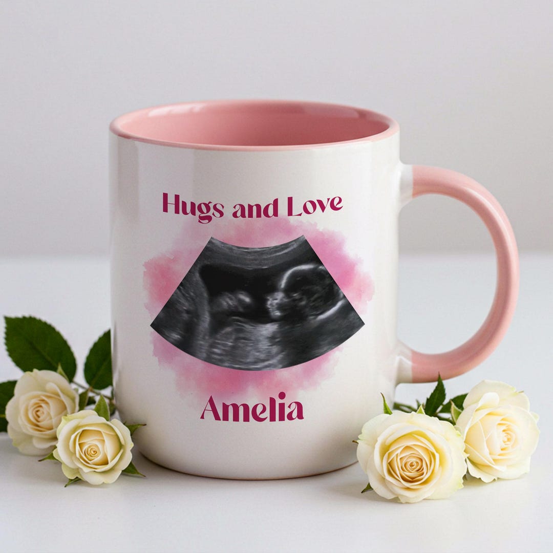 Custom Ultrasound Photo Mug • Personalized Sonogram Cup • Pregnancy ...