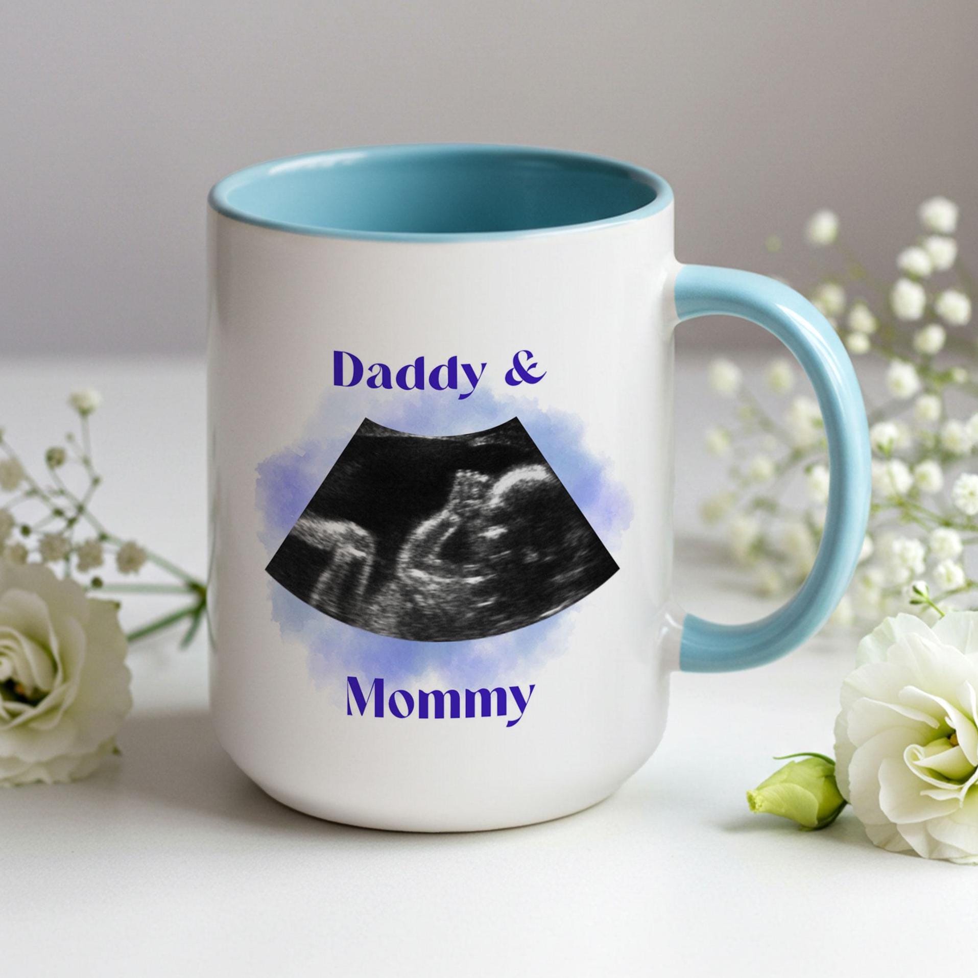 Custom Ultrasound Photo Mug • Personalized Sonogram Cup • Pregnancy ...