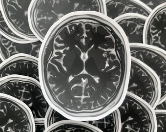 MRI Brain Scan Sticker | Waterproof Sticker | Neuroscience Themed Sticker | Brain Sticker