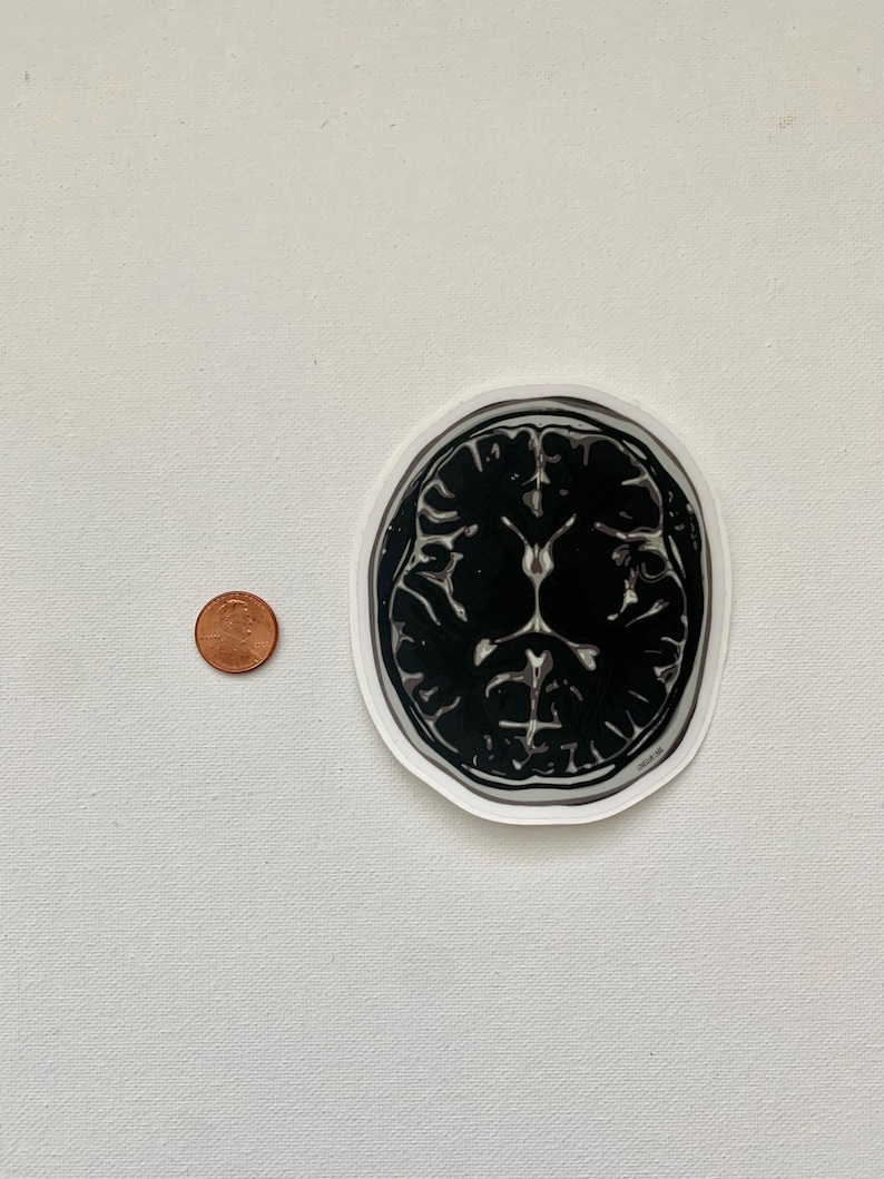 MRI Brain Scan Sticker | Waterproof Sticker | Neuroscience Themed ...