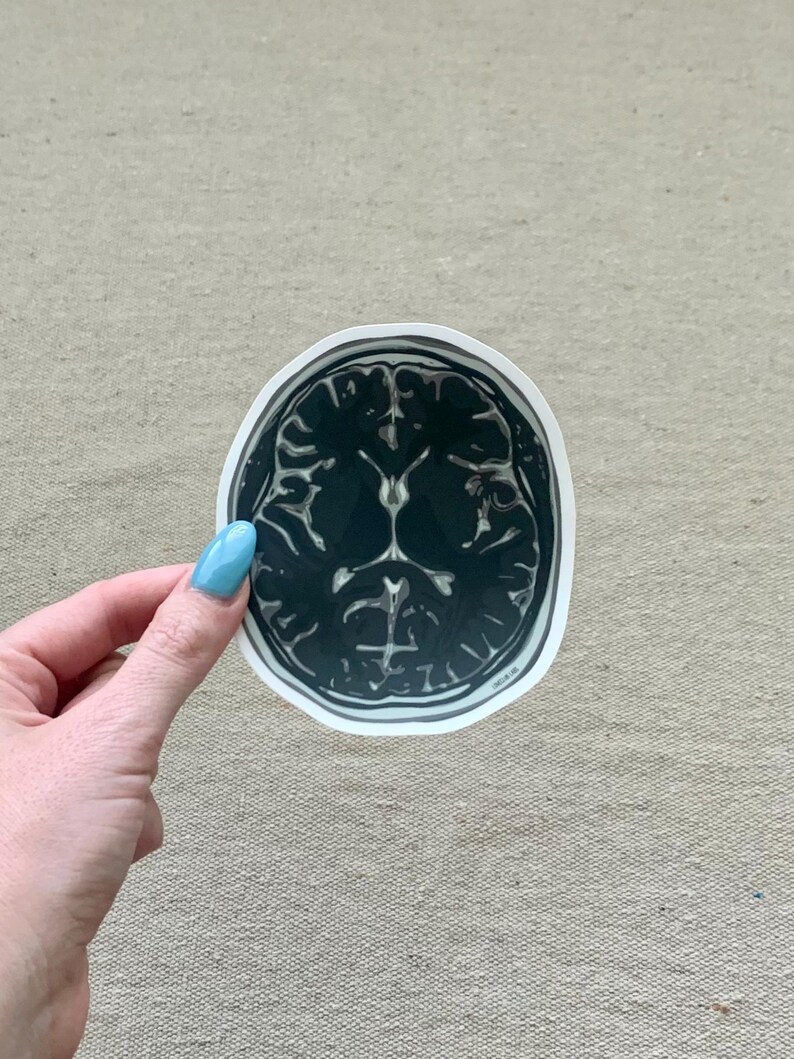 MRI Brain Scan Sticker | Waterproof Sticker | Neuroscience Themed ...