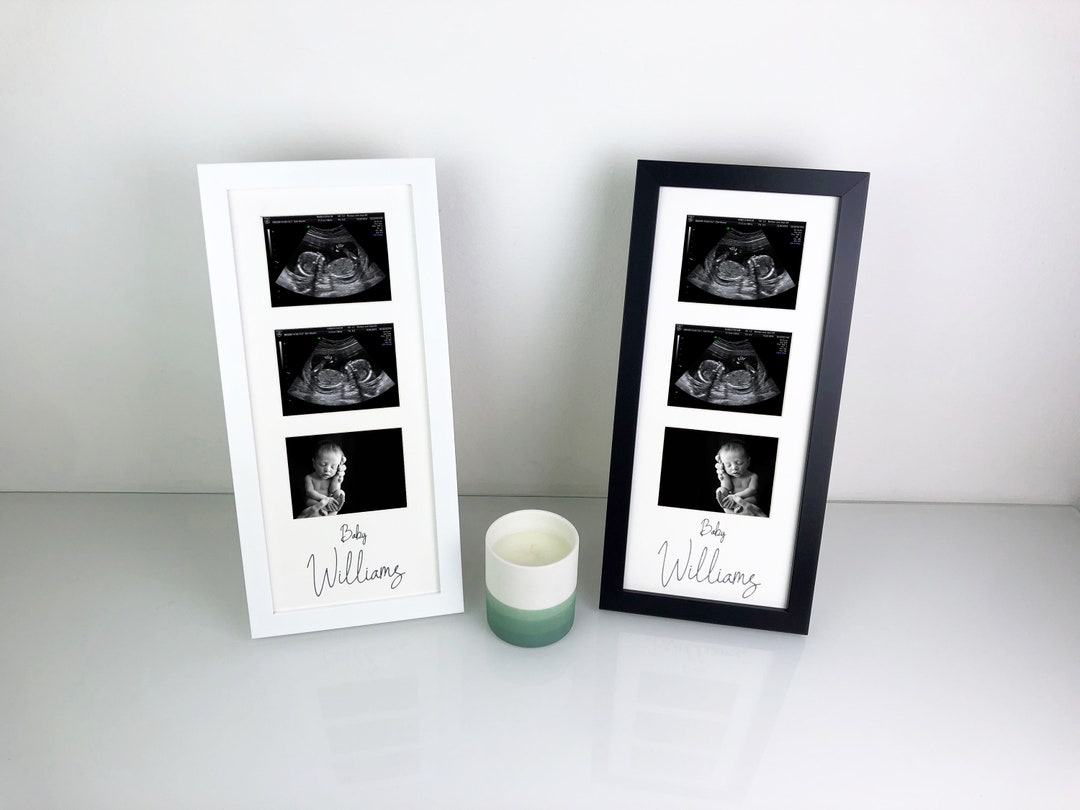 Personalised Ultrasound Baby Scan Photo Frame 3 Aperture Pregnancy