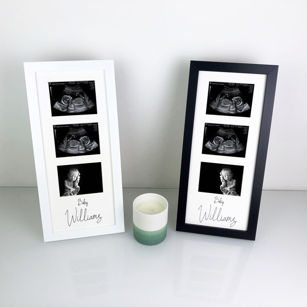 Personalised Ultrasound Baby Scan Photo Frame - 3 Aperture Pregnancy Picture Frames - Free Standing or Wall Mountable - White or Black