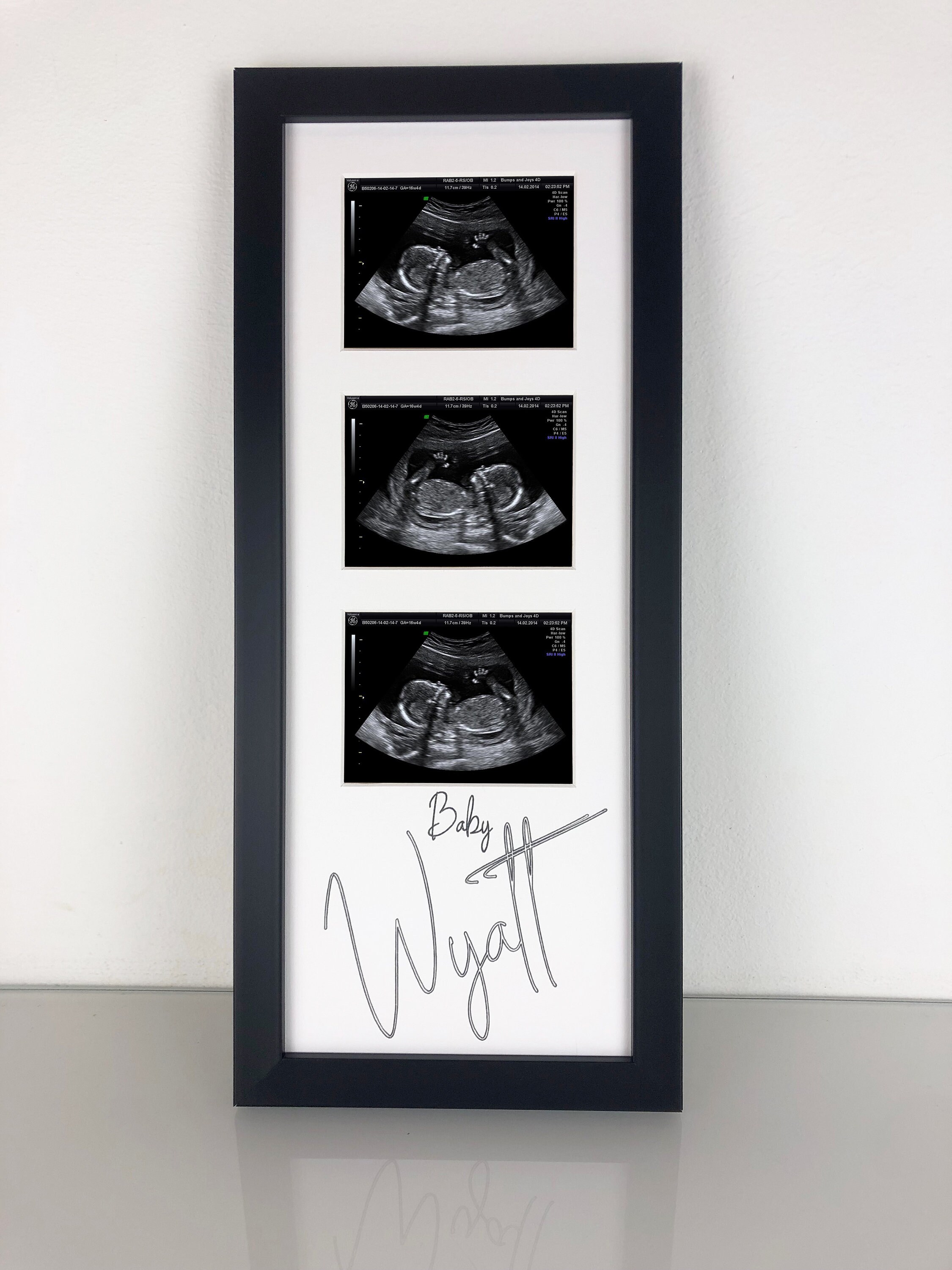 Personalised Ultrasound Baby Scan Photo Frame 3 Aperture Pregnancy