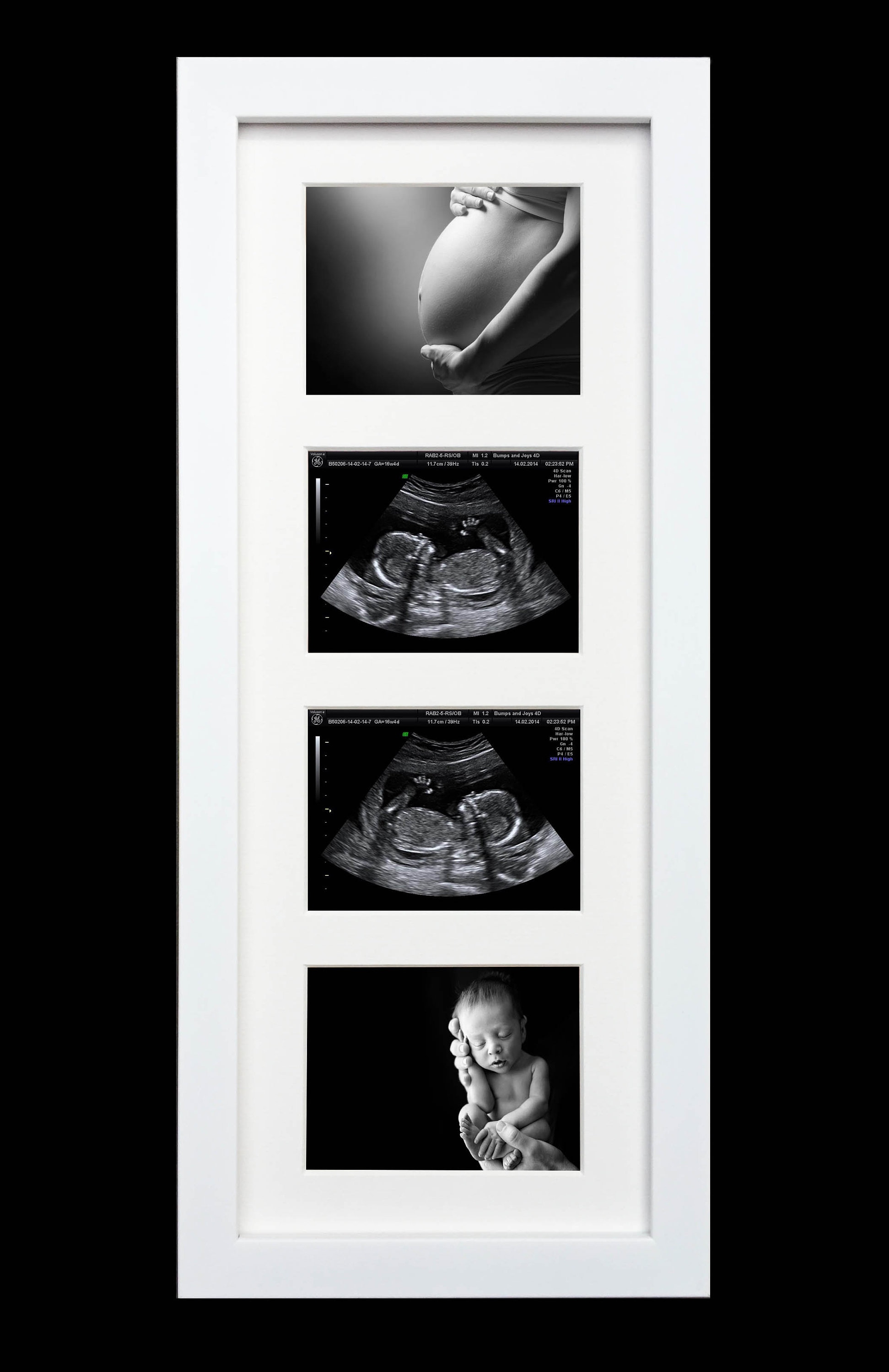  trlry Triple Ultrasound Picture Frames, Sonogram Picture Frame  3 Photos,Pregnancy Announcements,Pregnancy Gifts for First Time Moms,First  Time Mom Gift,Black,Ultrasound Photo Album : Baby