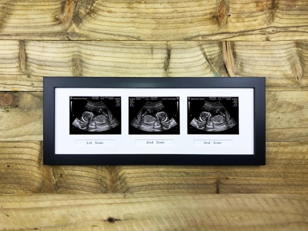 Personalised Ultrasound Triple Baby Scan 3 Photo Frame Multi Aperture ...