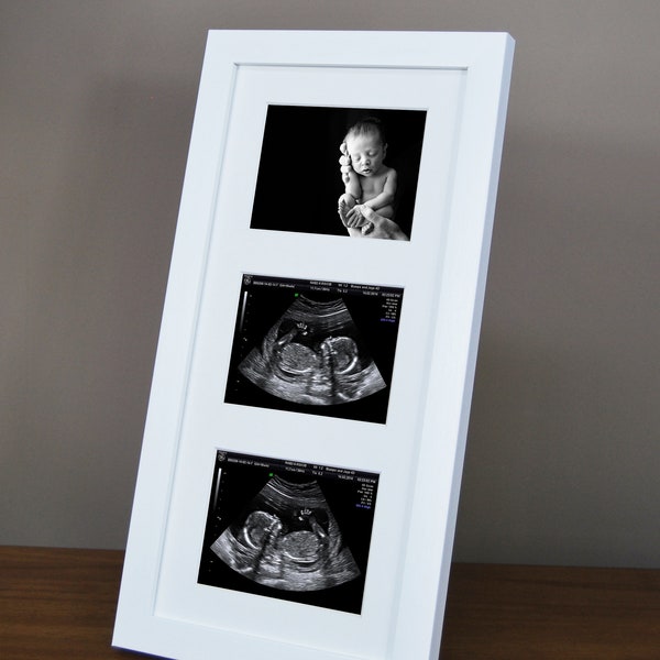 Ultrasound Baby Scan Photo Frame - 3 Aperture Pregnancy Picture Print Frames - Free Standing & Wall Mountable -  White or Black - Gift Idea