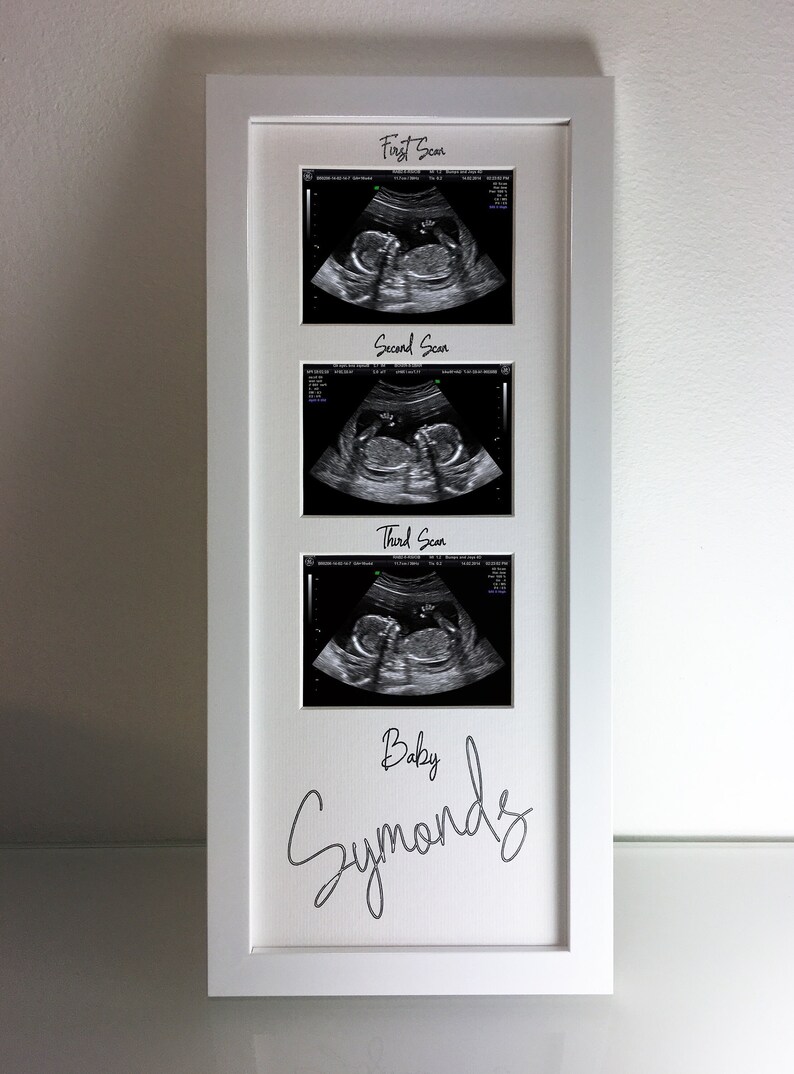 Personalised Ultrasound Baby Scan Photo Frame 3 Aperture Pregnancy